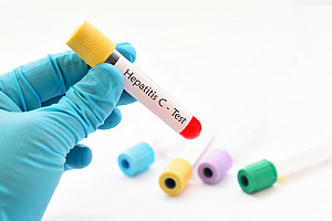 Hepatitis: Erkrankung behandeln und vorbeugen