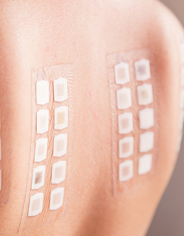 diagnose allergischer Husten