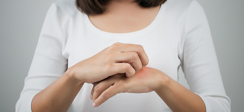 Kontaktallergie: Reaktionen durch Modeschmuck