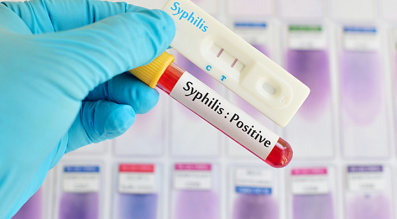 Syphilis: frühzeitige Therapie garantiert vollständige Heilung