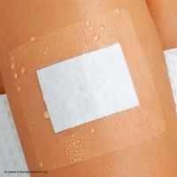 tg soft Polsterschlauchverband Gr. S, 1 st, Lohmann & Rauscher GmbH & Co. KG