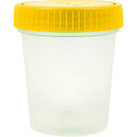 URIN PROBENBECHER steril, 1 st, LUDWIG BERTRAM GmbH