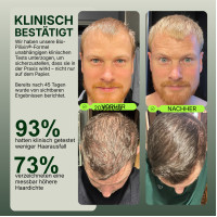 Bio-Pilixin Hairline Booster refill, 3x15 ml, Scandinavian Biolabs ApS