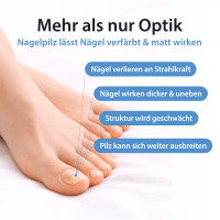 Acetocaustin Nagelpilz L&ouml;sung mit Aufhellung, 9 ml, TheOTCLab B.V.