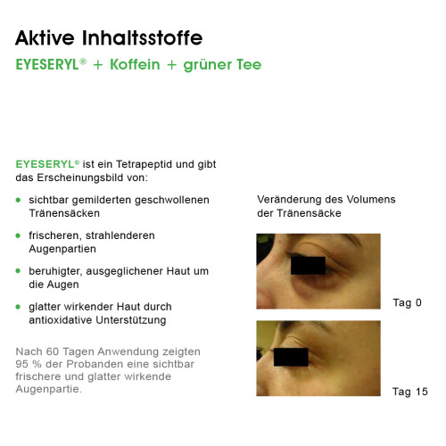 BIOMED Tr&auml;nens&auml;cke Serum Eye Bags Away, 15 ml, Herba Anima GmbH