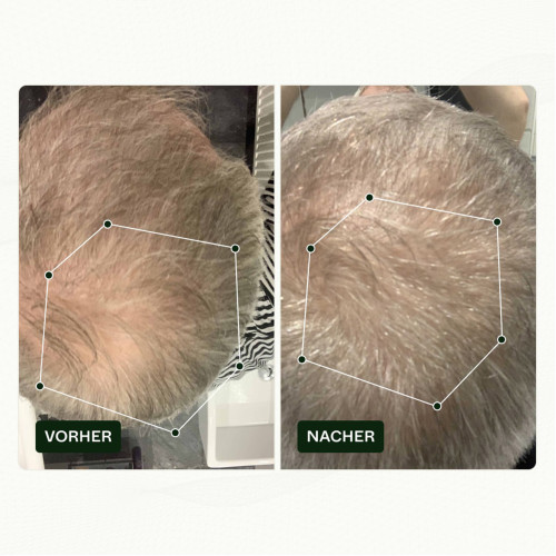 Hair Growth-Routine I Für Männer Set, 1 Pck., Scandinavian Biolabs ApS