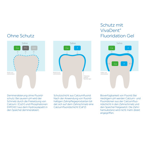 VivaDent Fluoridation Gel, 75 ml, Ivoclar Vivadent GmbH