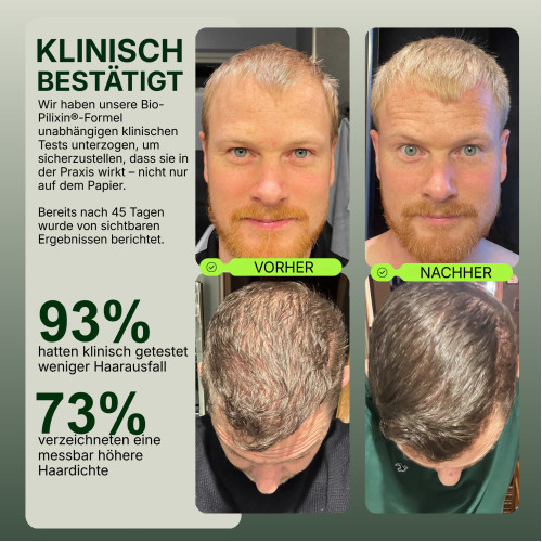 Bio-Pilixin Hairline Booster refill, 15 ml, Scandinavian Biolabs ApS