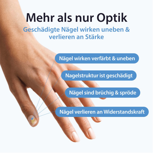 Acetocaustin Nage Pflege & Reparatur L&ouml;sung, 9 ml, TheOTCLab B.V.